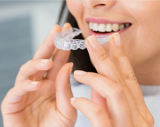 Invisalign 1