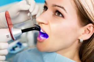 Woman having dental bonding treatment performed on her teeth to enhance her smile