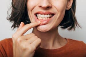 Close up of a woman poking at her teeth due to sensitivity after teeth whitening treatment.